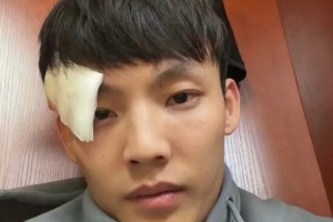 眉骨缝了3针！徐杰晒照：新赛季 为广东而战 兄弟齐心 开门红